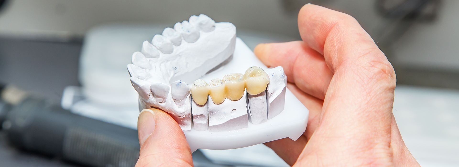 The image shows a person holding a 3D printed dental model with an upper denture, which includes teeth and gums, while examining it closely.