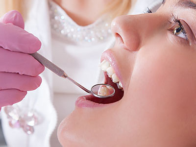 This is a photograph featuring a woman with her mouth open wide while sitting in a dental chair, receiving dental care from a professional wearing protective gloves and a surgical mask.