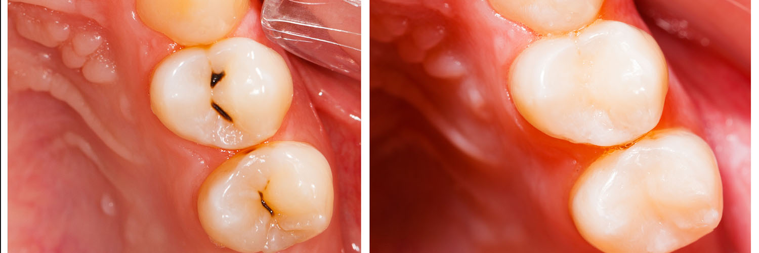 The image shows a close-up view of a mouth with teeth, gums, and a tongue, highlighting dental care procedures such as brushing, flossing, and orthodontic work.